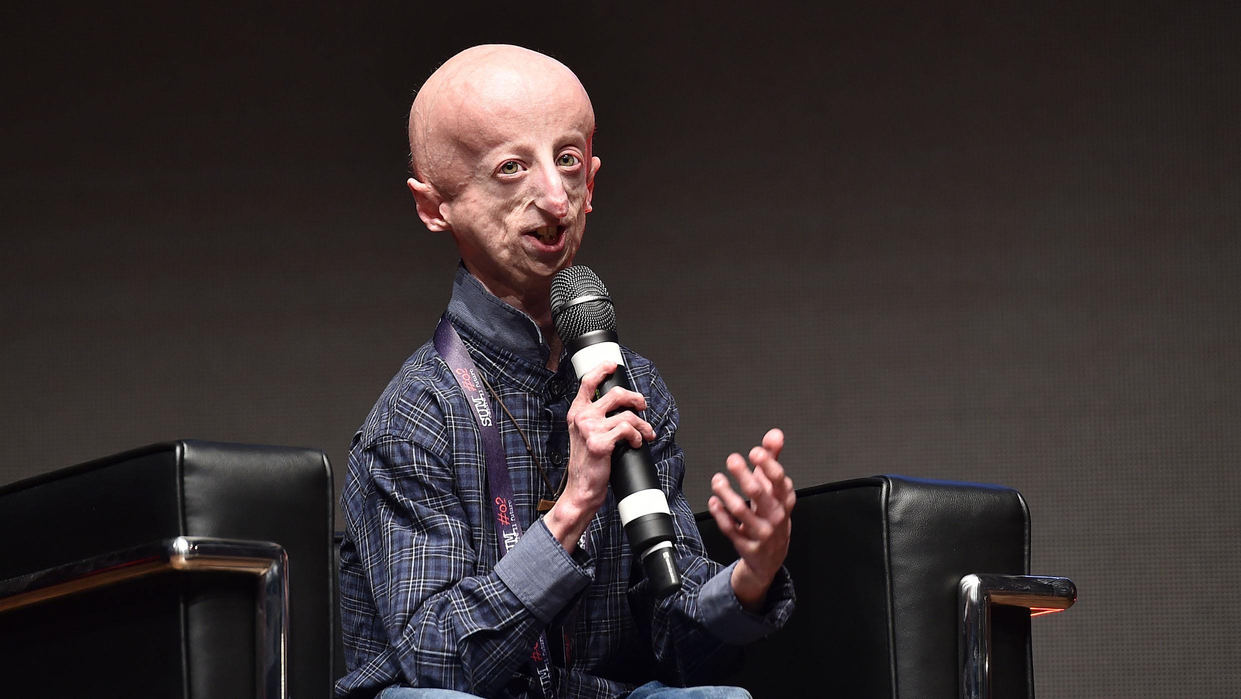 Sammy Basso, una vita con la Progeria: la malattia e i funerali